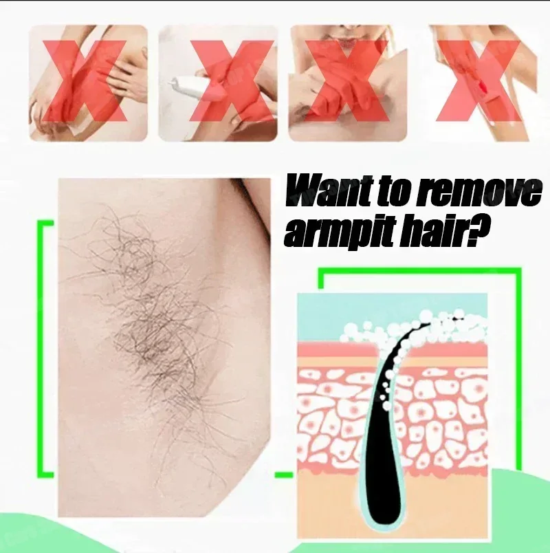 제모 스프레이 강력한 제모 효과 건강하고 통증 없는 제 - Hair Care Korean Products 리뷰 및 가격