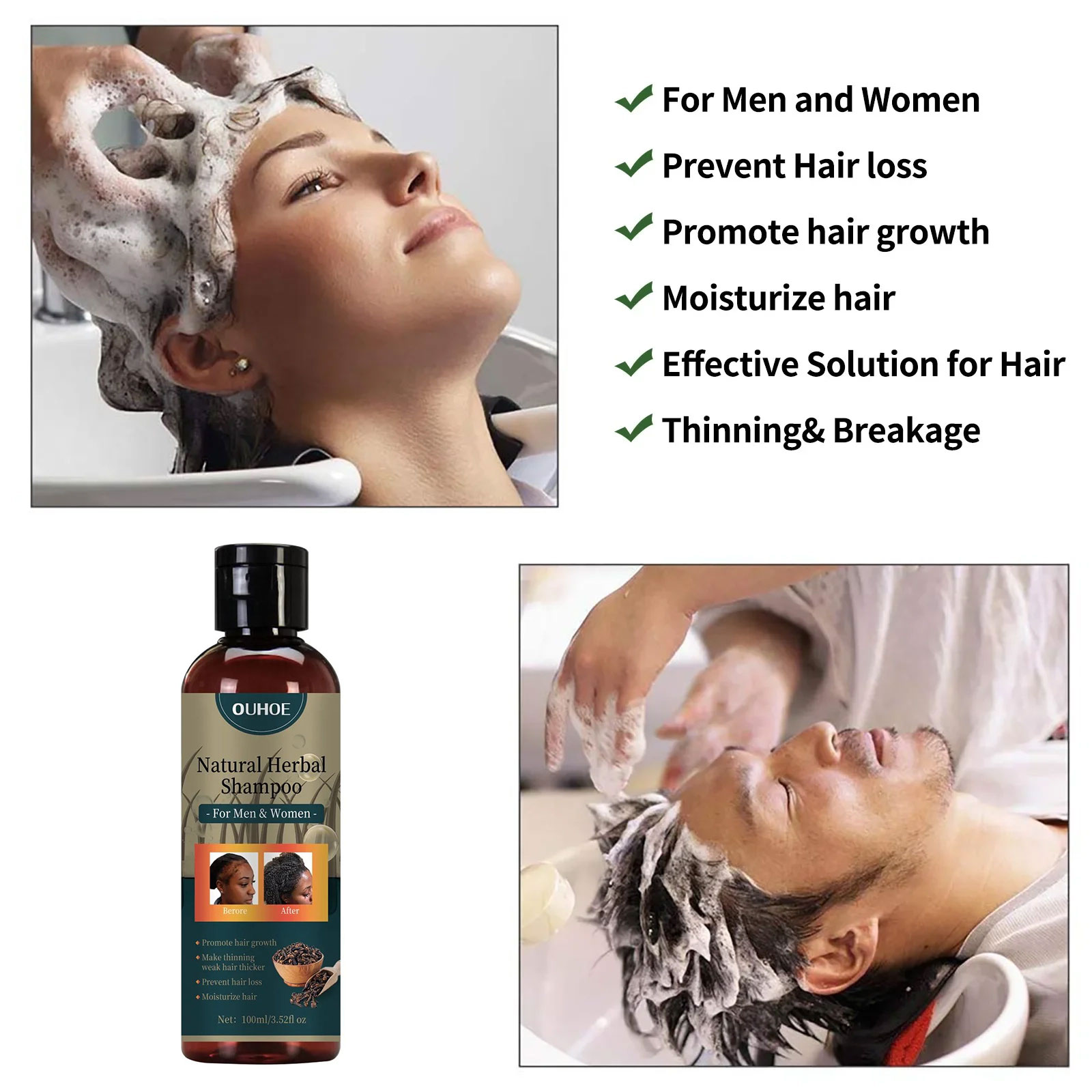 OUHOE 모발 성장 샴푸 안티 비듬 제거 얇은 오일  - Hair Care Dandruff 리뷰 및 가격