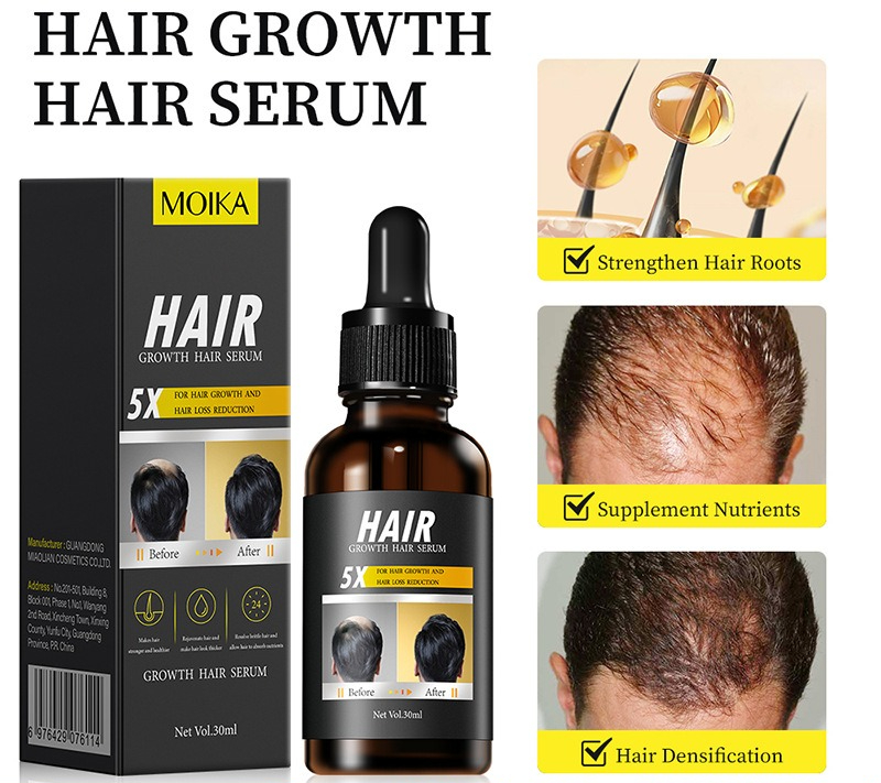 모발 성장 에센셜 오일 두피 영양 세럼 탈모 방지 모발 - Hair Care Organic 리뷰 및 가격